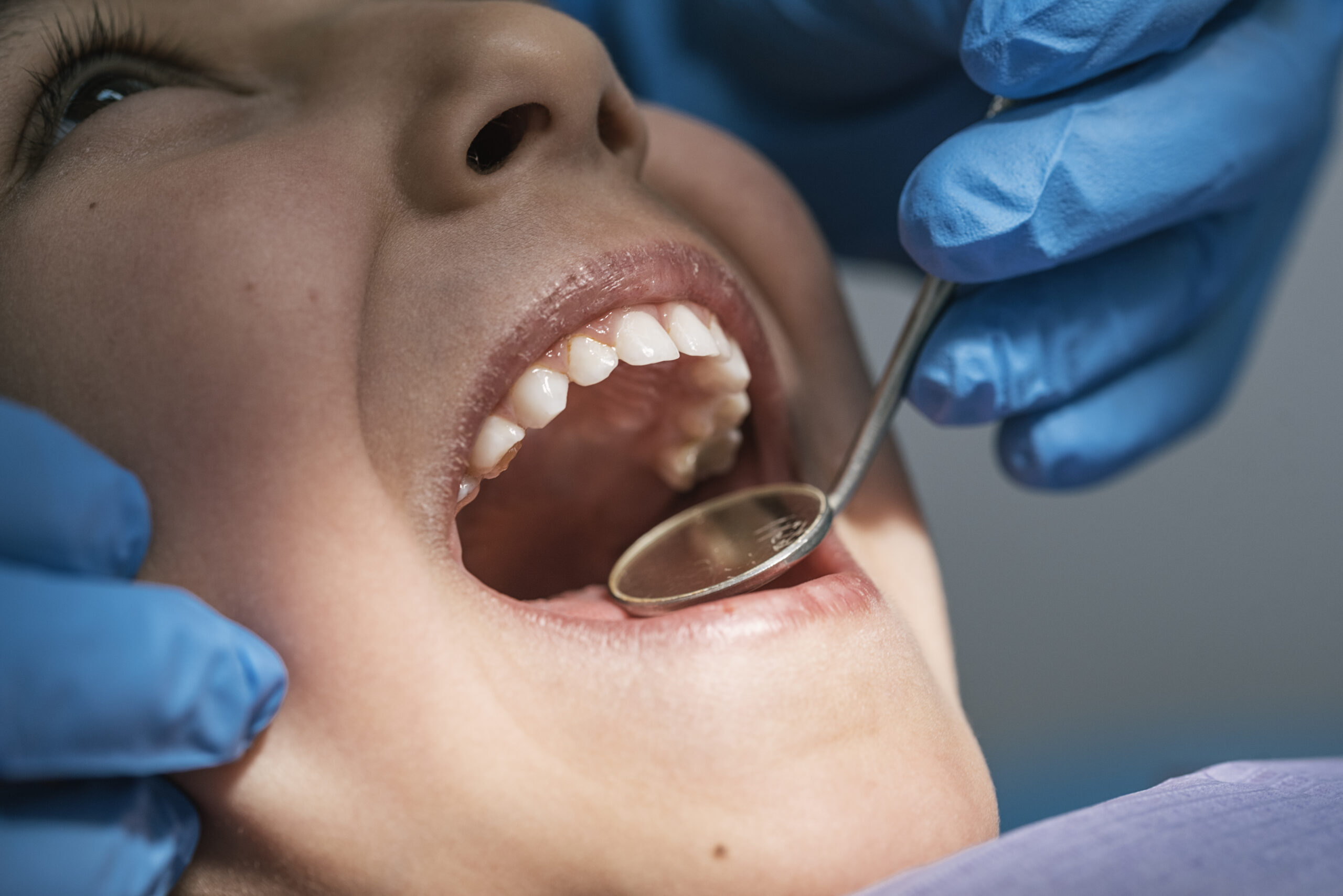 Заболевания эмали зубов, Северо-Восточный Стоматологический Центр №1