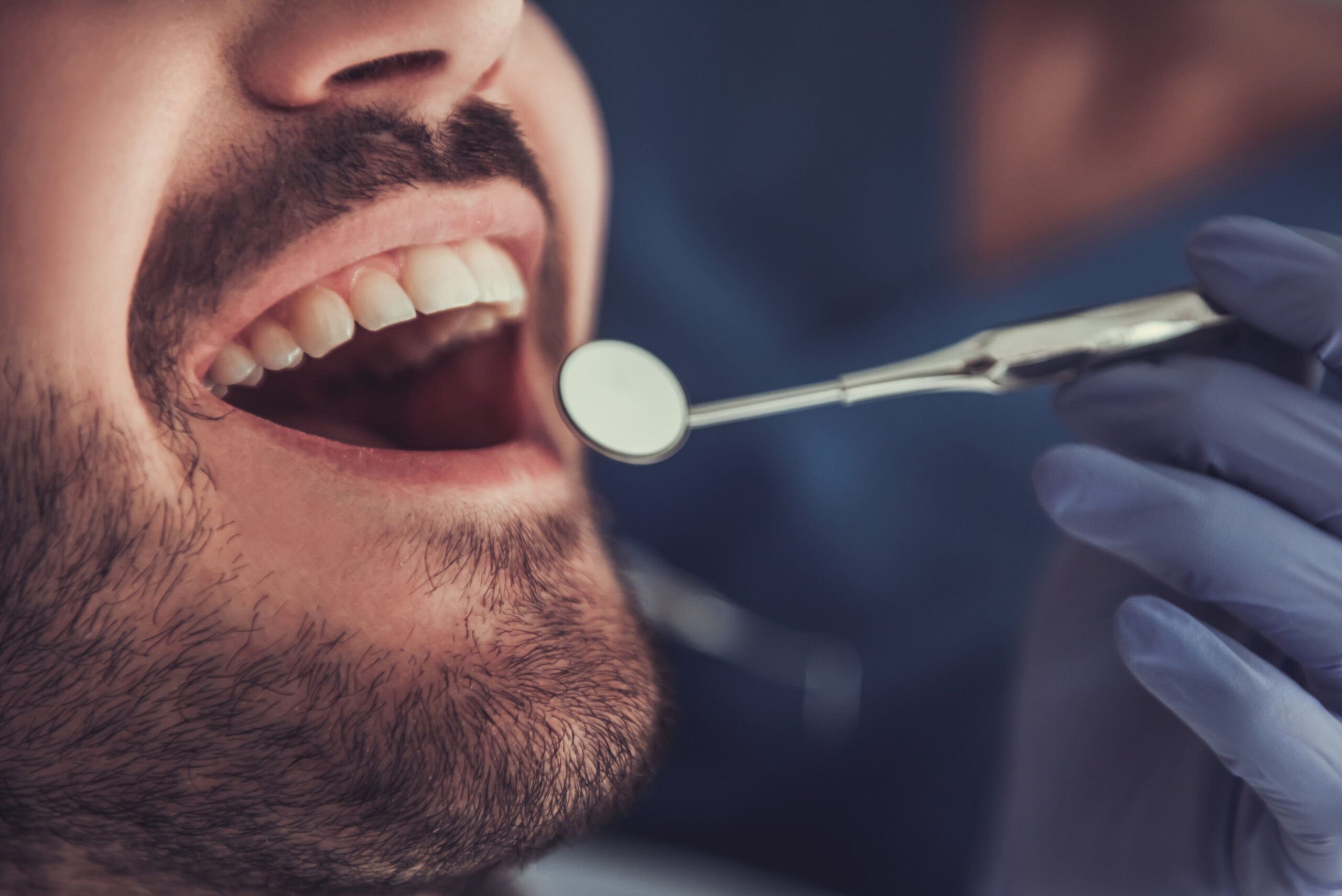 Периодонтит зуба: что это такое — симптомы и как его лечить, Северо-Восточный Стоматологический Центр №1